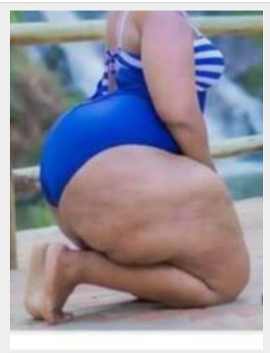 Missing Profile Picture