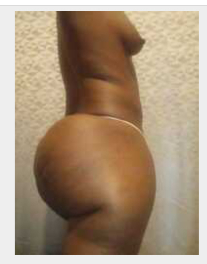 Missing Profile Picture