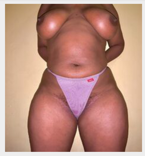 Missing Profile Picture